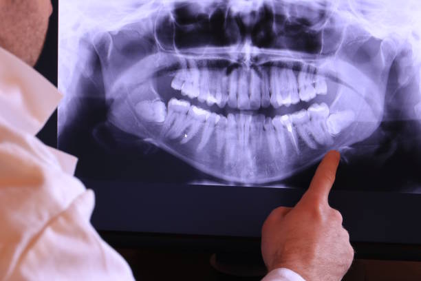 Best Emergency Dental Surgery in Clay City, IN